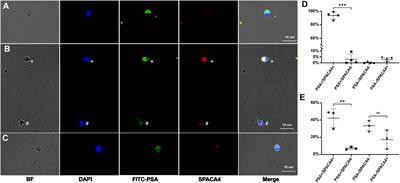 Spermatogenic cell-specific SPACA4 is essential for efficient sperm-zona pellucida binding in vitro